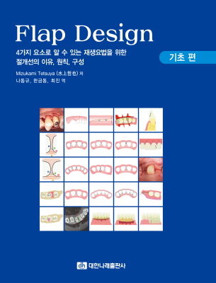 Flap Design – 