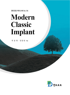Modern Classic Implant