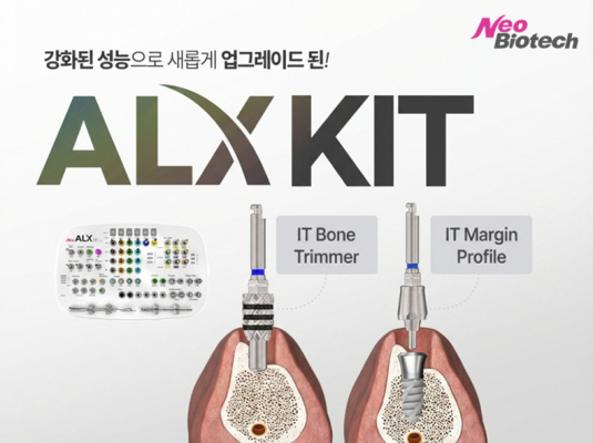 �׿� ��ALX KIT�� ����� ���е� ���׷��̵�