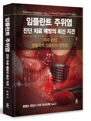 ���ö�Ʈ ������ ���� ġ�� ������ �ֽ� ����