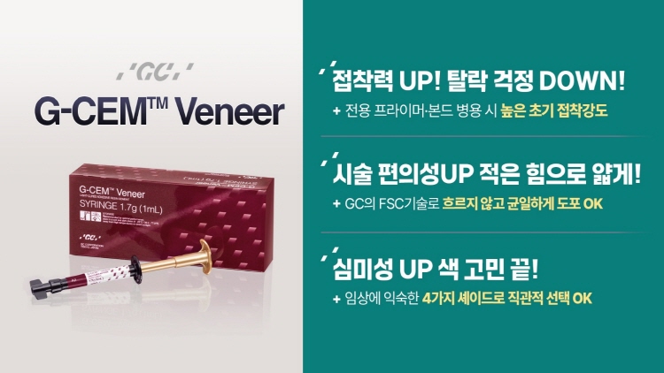 GC ��Ͼ� ���� �ø�Ʈ ��G-CEM Veneer�� 15�� ����