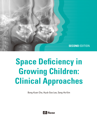 Space Deficiency in Growing Children: Clinical Approaches -2nd Edition